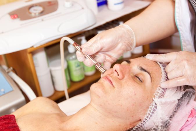 dermabrasion