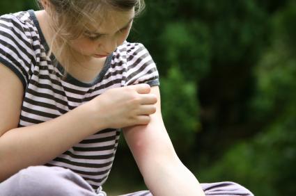 Itchy Girl