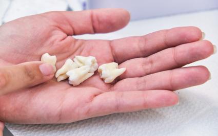 Variety of dentures in dentist hands